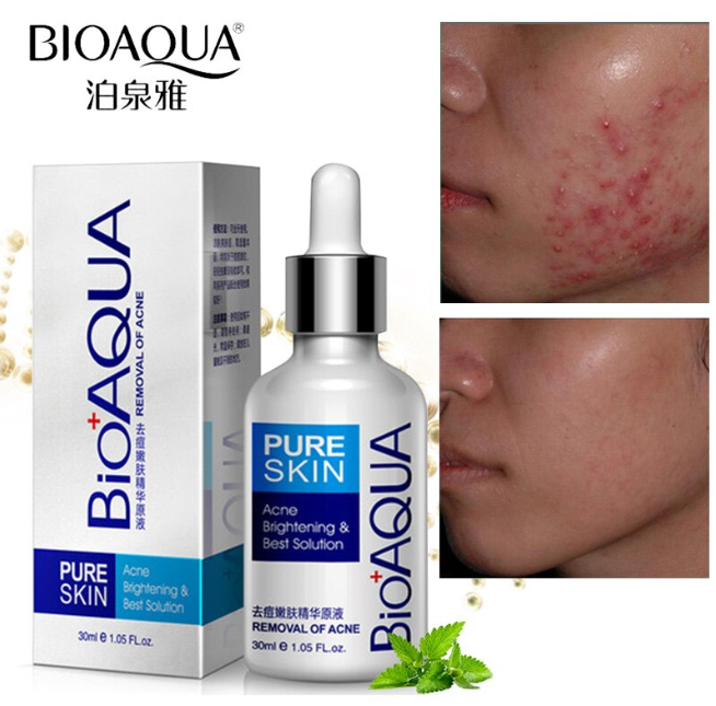 BIOAQUA SERUM ANTI ACNE 30ml
